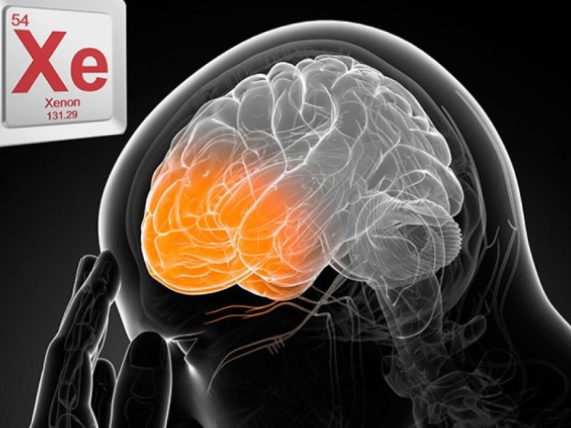 Assessing the suitability of Xenon treatment for mass use in cases of Neonatal Hypoxic Ischemic&nbsp;Encephalopathy